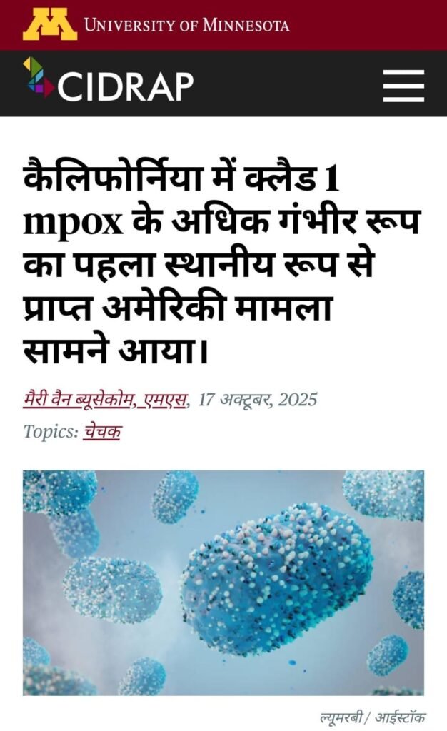 MPOX की खबर